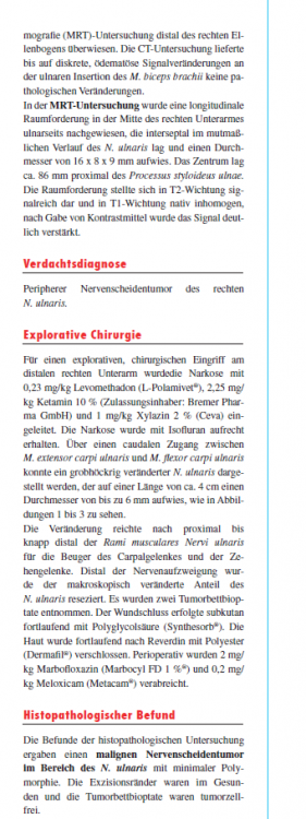 2014-01-15 09_10_43-Maligner peripherer Nervenscheidentumor.pdf - Adobe Reader.png